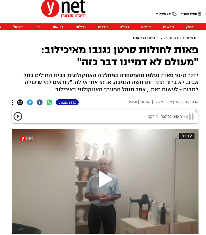 גניבת פאות  מאיכילוב