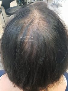 יחידות שיער עם קליפסים